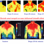 probleme circulatie sanguina